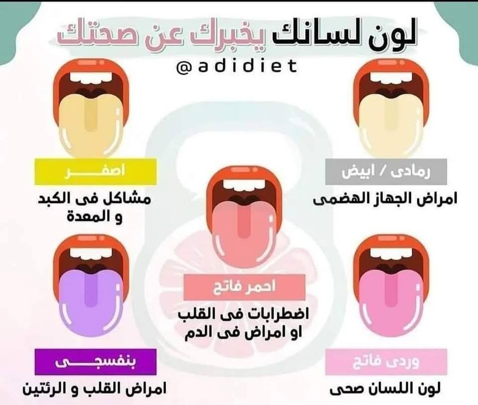 لون لسانك يخبرك عن صحتك